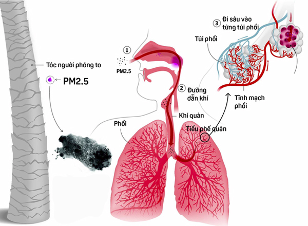 bụi mịn PM 2.5 ảnh hưởng nghiêm trọng đến sức khoẻ